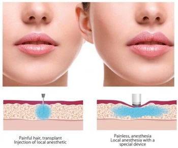 2ml HA Injectable Dermal Filler For Fine Wrinkles
