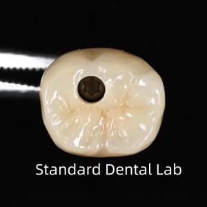 Quality Screw Retained Dental Implant Crown wholesale