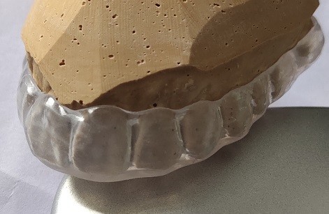 Transparent Night Guard For Bruxism
