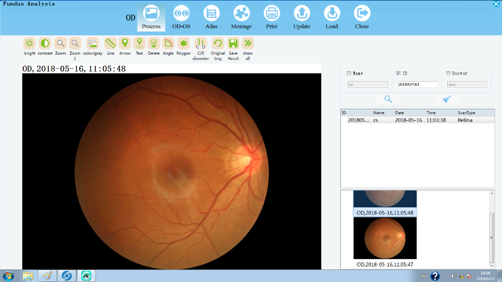 Professional Optical machine/ OCT with fundus camera function Optical Coherence Tomography