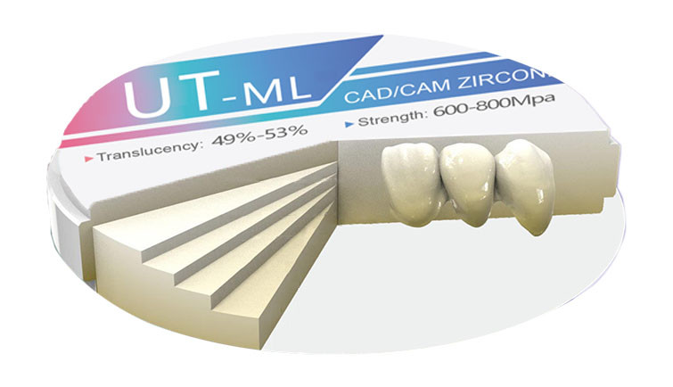 UT-ML Medical Zirconia Disc / Zero Cytotoxicity | ≤3-Unit Prosthesis / 1500℃ Sintering Recommended