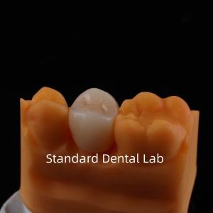 Quality Full Contour Zirconia Crown Exceptional Strength and Esthetics No Porcelian Overlay Posterior Crown China Dental Lab wholesale