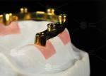 Titanium Sandblasted Implant Locator Bar Silver Gold Dental Implant Locator