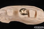 Custom Oral Clinical Wear Resistant Gold Dental Crown With 60K Metallic