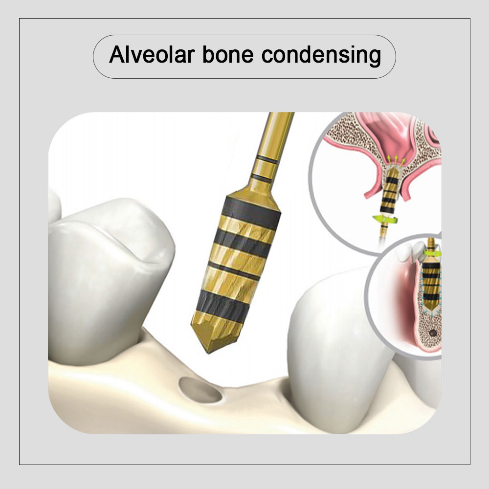 Multi Functional Dental Implant Tools With Stopper For Alveoloar Bone Expanding And Drilling