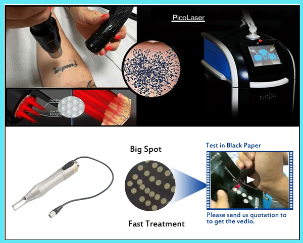 Picosecond q switched nd yag laser / picosure laser machine