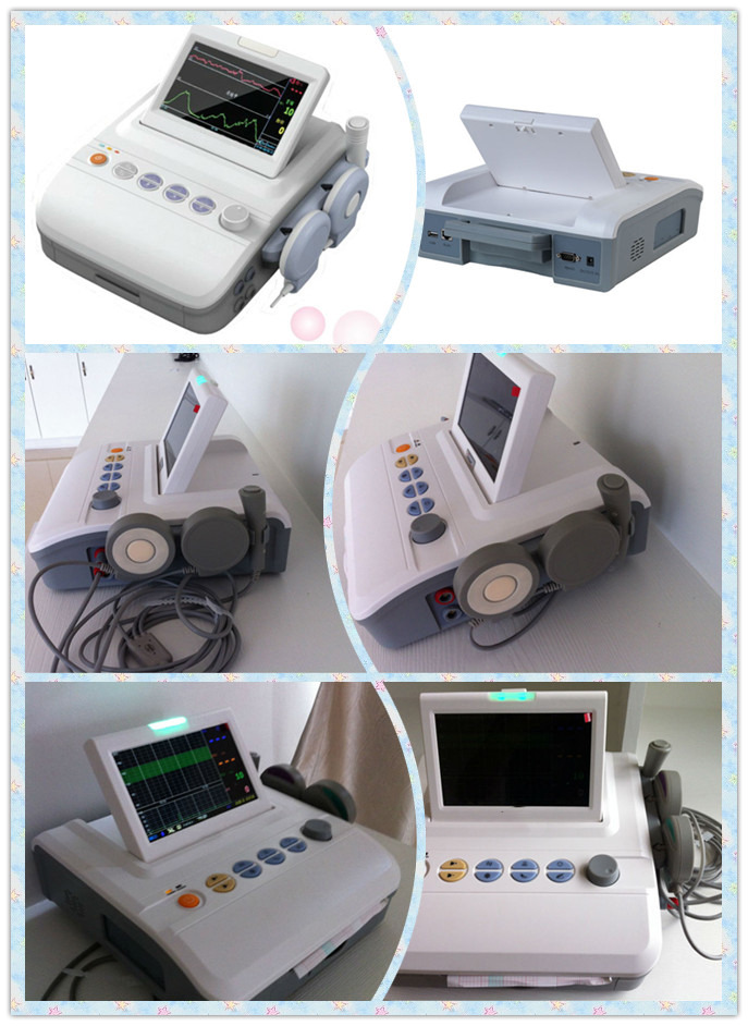 Top Quality CTG Fetal Monitor Price