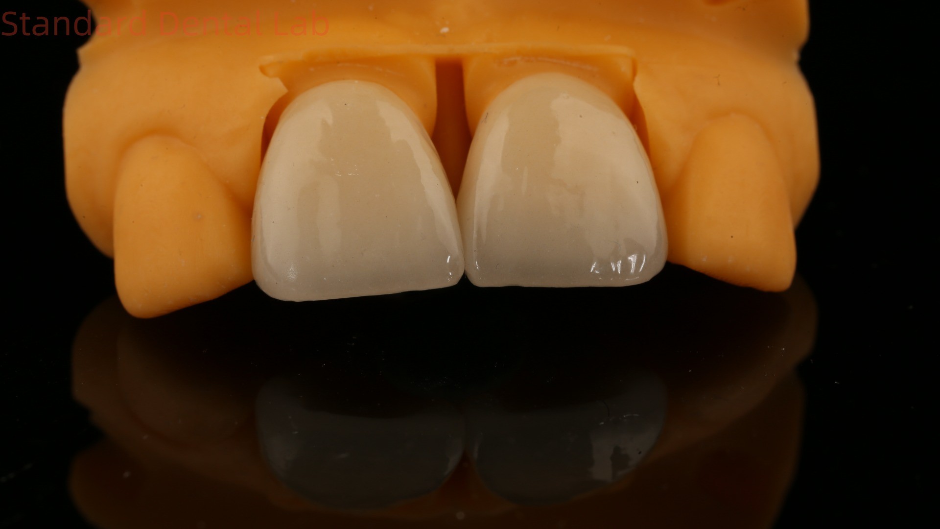 5 Year Guarantee Full Contour Zirconia Crown Customized Vita Shade High Aesthetic Natural Dental Bridge