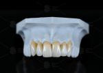 High Translucency Full Contour Zirconia Bridge Chipping Resistance Natural