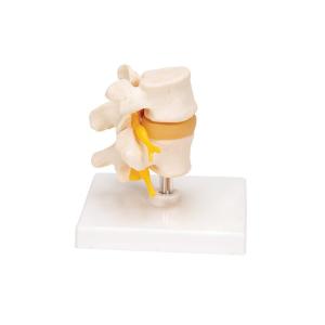 Quality 0.45kg Medical Anatomy Education 20x16x10cm Lumbar Spine Model wholesale