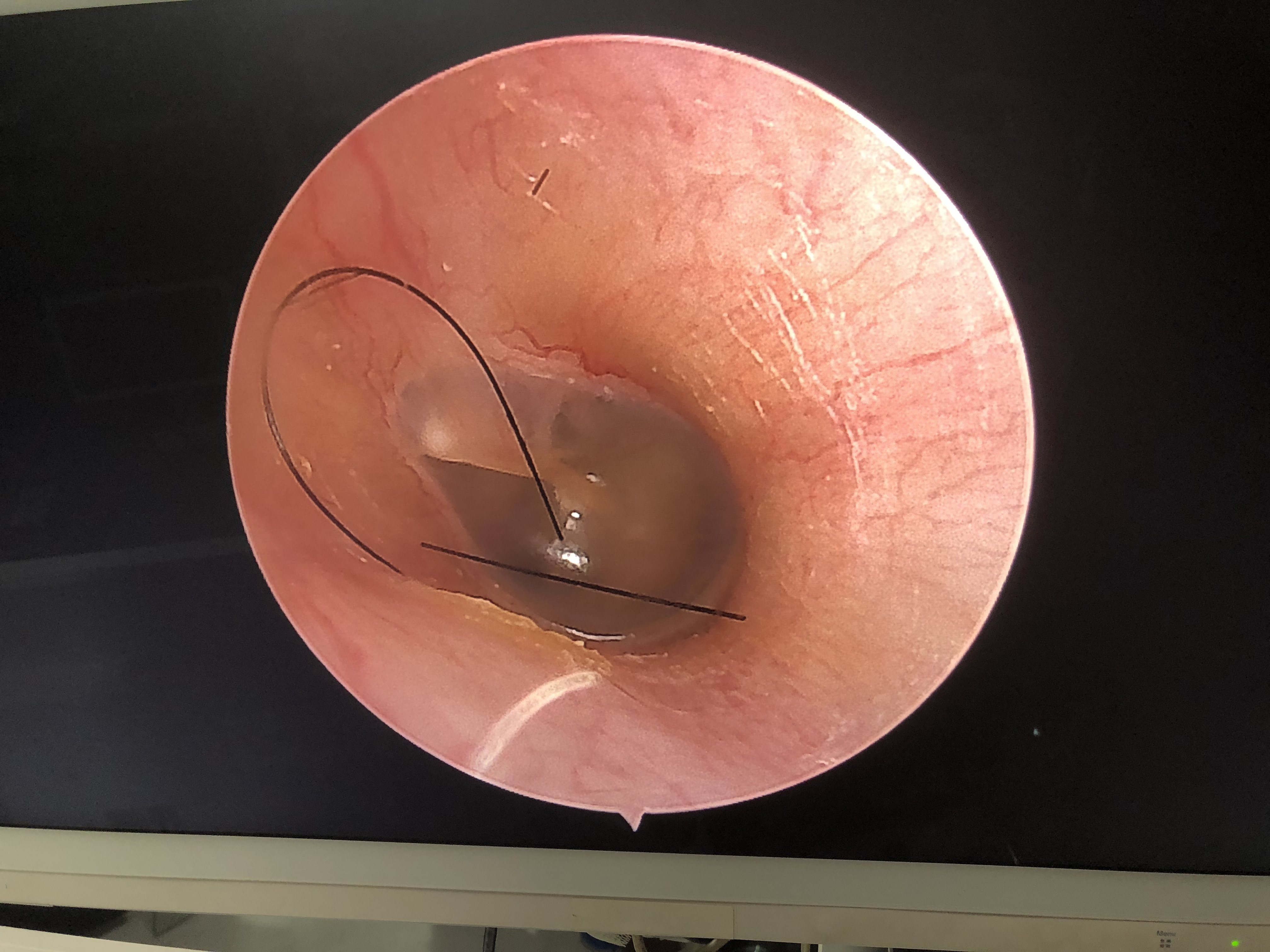 TUYOU White Flexible Endoscope Camera With HD Resolution For Medical laparoscopy machine