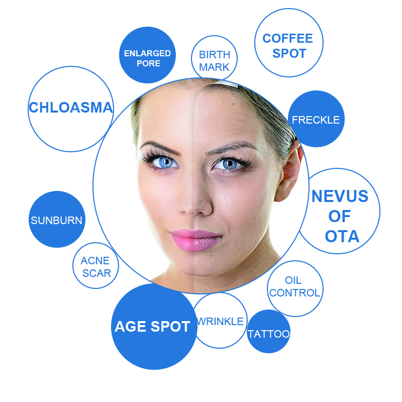 best selling products picosure 755 nm laser picosecond beauty machine