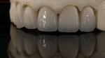 China Dental Lab Zirconia Full Contour Crown High Aesthetic Natural Dental