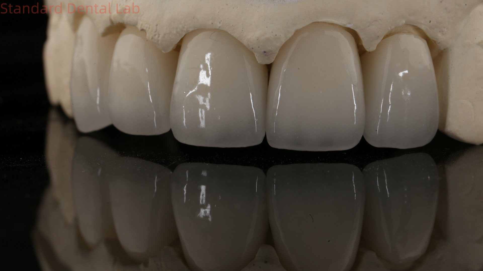 China Dental Lab Zirconia Full Contour Crown High Aesthetic Natural Dental Bridge 5 Year Guarantee