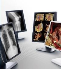 Quality Clear picture Medical Grade Displays , 5MP Gray Scale Medical Display wholesale