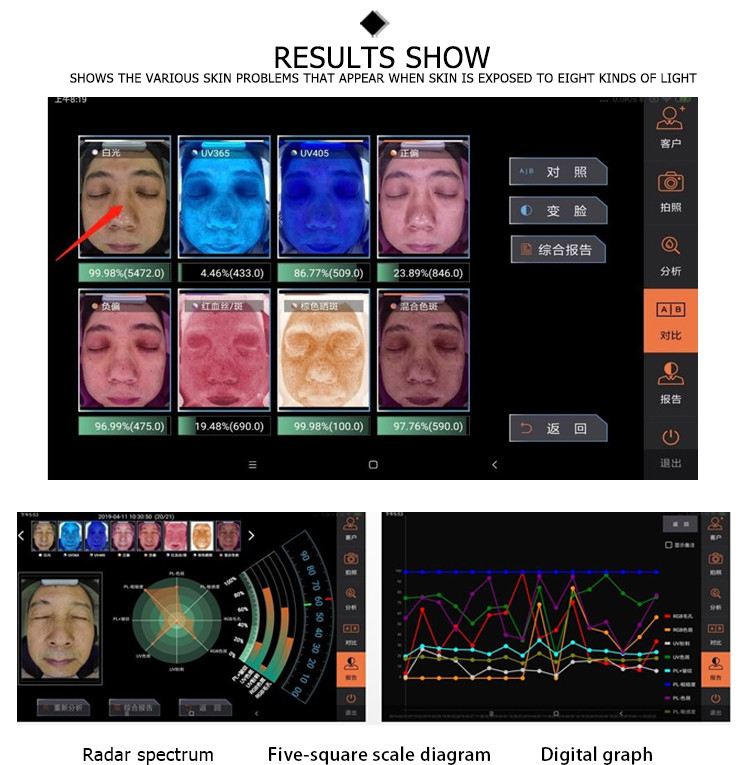 magic mirror skin analyzer health analyzer UV Images skin analyzer CE approval machine beauty device skin 3d analyzing