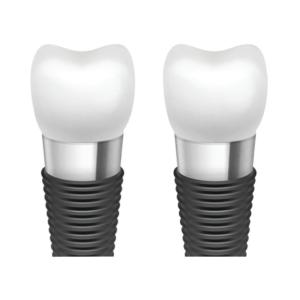 Quality Enhancing Oral Aesthetics With Dental Implant Bars wholesale