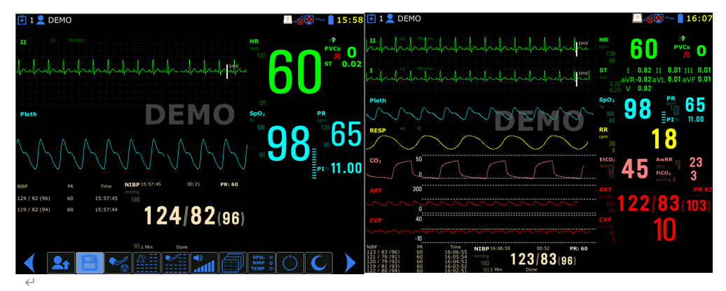 15 inch TFT screen multiparameter medical mobile ambulance patient monitor for hospital