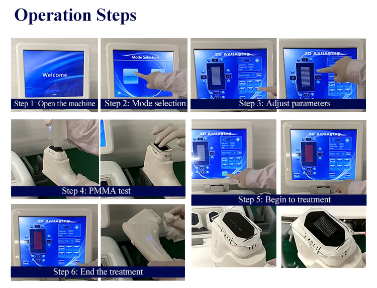 Ultrasound High Intensity Focused Ultrasound Machine 3D Anti Wrinkle Skin Tightening