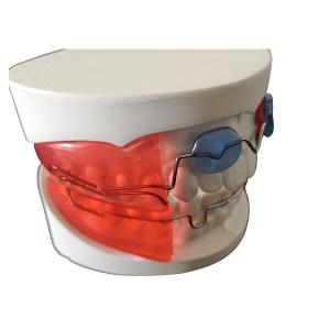 Quality Dental Orthodontic Appliances Simple Install HighTech Biological Material wholesale