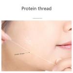 Carving Gold Protein Peptide Thread Reduce Forehead Lines