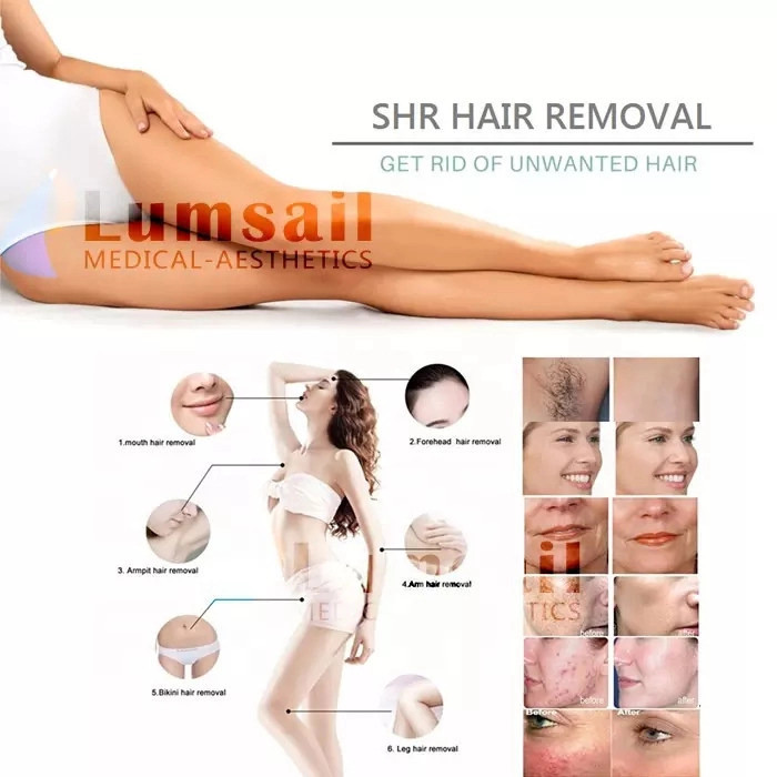 LZR P6 Picosecond Laser Machine 810 Skin Rejuvenation Machine With 2-10 Mm Spot Size