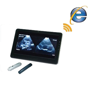 Laptop color Doppler ultrasound system Uprobe-1