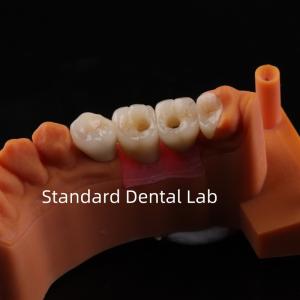 Quality Porcelain Zirconia Dental Implant Bridge Professional High Esthetics wholesale
