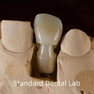 Quality Dental Implant Tibase Zirconia Abutment Titanium Accuracy Customized wholesale