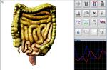Healing Treatment Metatron Nls 4025 Hunter Body Analyzer for Bones Inspection