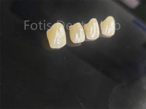 Quality Professional Grade Porcelain Fused Zirconia For Perfectly Fitting Dental Restorations wholesale