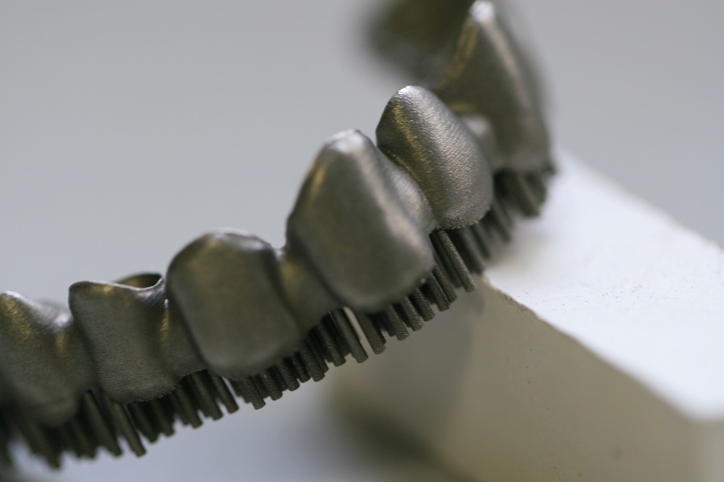 Metal Framework PFM Dental Crown