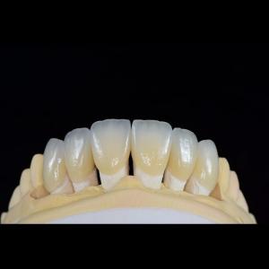 Quality Dental Lab Teeth Feldspathic Porcelain Veneers Custom Shaped wholesale