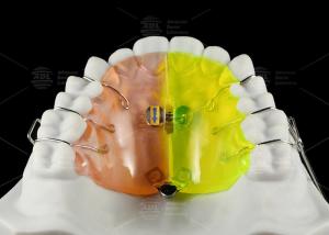 Quality Orthodontic Fan Shaped Expander Provides Posterior Crossbite Free Section Expansion wholesale