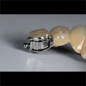 Quality Aesthetic Precision Dental Implant Ball Attachment Partial Dentures wholesale