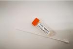 Rapid Detection Virus Preservation Tube High Collection Rate Virus Specimen Tube