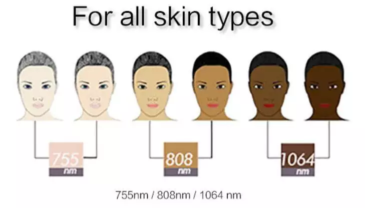 808nm / 755nm / 1064nm Diode Laser Hair Removal Machine Custom