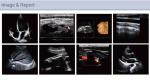 Cardiovascular Cardiology Portable Full Figital Color Doppler Ultrasound Scanner