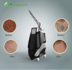 Tattoo removal birthmark removal PICO SURE Nd:YAG laser