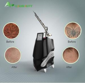 Quality Q-switched tattoo removal beauty equipment 1064/532nm standard nd yag pico second laser wholesale