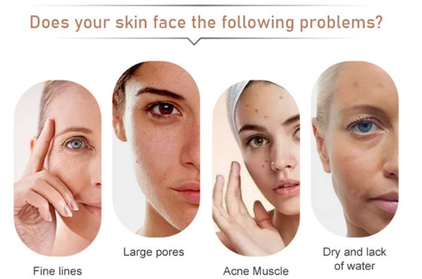 Anti Aging Skin Booster PDRN Baby Needle Injectable Mesotherapy