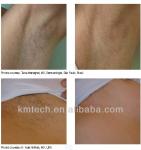 Professional Clinic Laser Hair Removal Machine Diode 3 waves KM960D