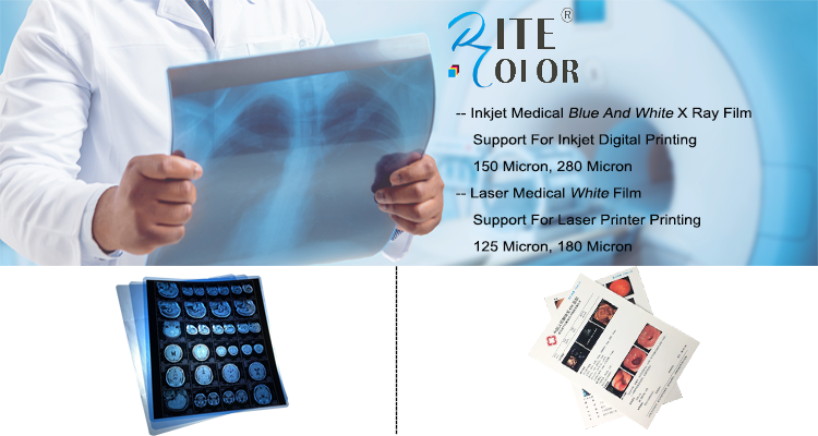 Healthcare PET Based X Ray Medical Imaging Film Waterproof Transparent