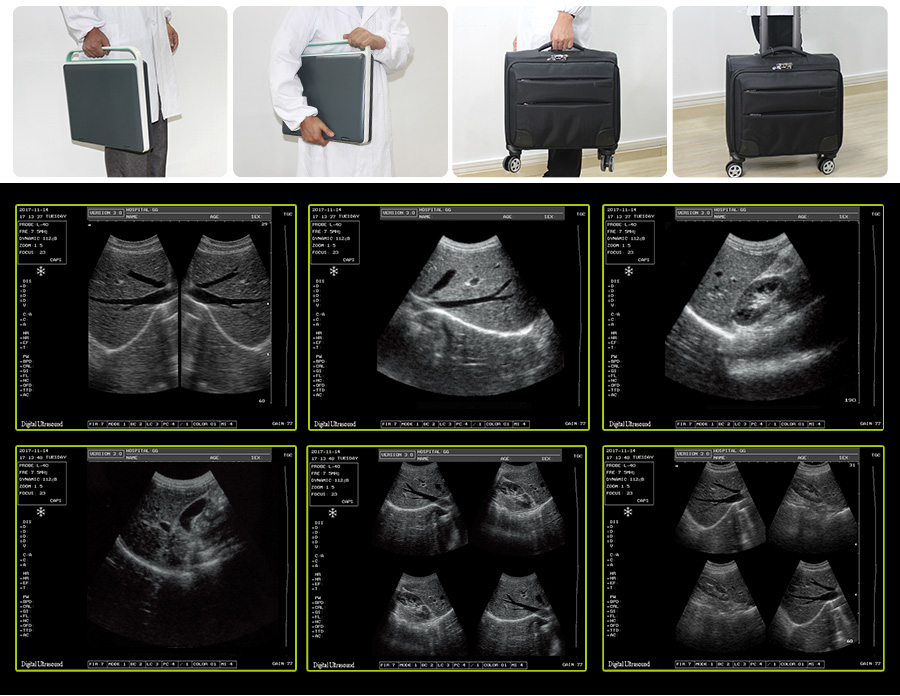 15 inch Cheap Hotsell SS-7 Vet Ultrasound Portable Machine Equipment High Image