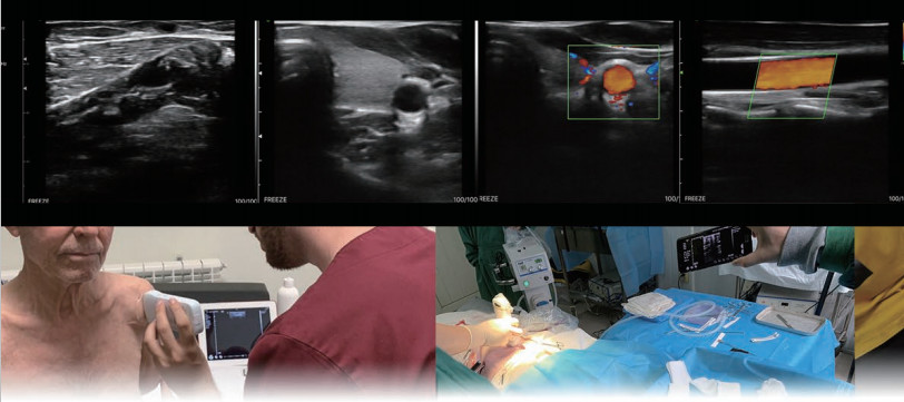 GH 192 Elements Color Doppler Ultrasound Wireless Linear Probe 7.5mhz 10mhz G10CX