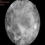 2.8mm Wide Field Fundus Camera Retinal Imaging Equipment