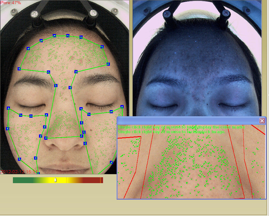 Intelligent Uv Light Facial Scanner Skin Analyzer 20 Seconds Speed