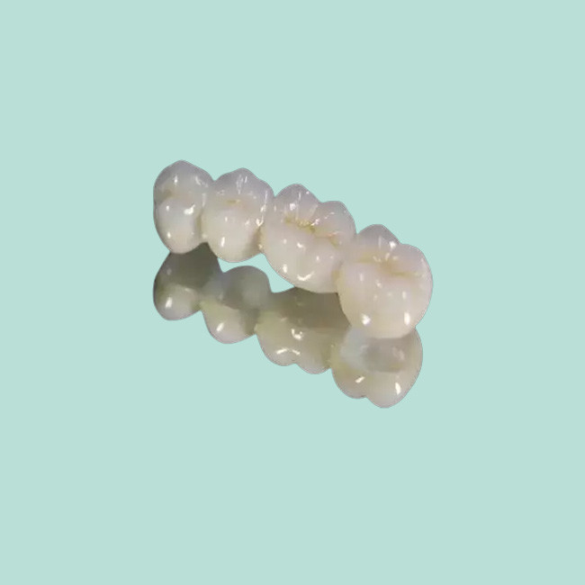 Composite Fixed Bridge Crown Confident Beautiful Crowns And Bridges