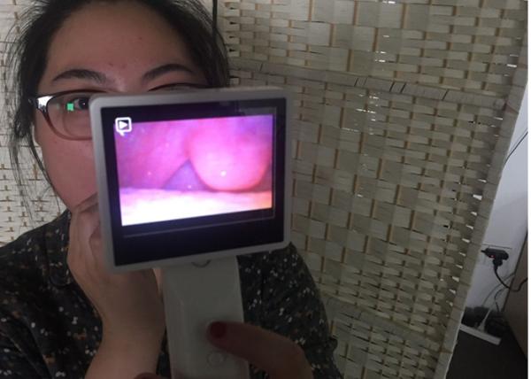 High Resolution Portable Endoscopy Larygoscope Rhinoscope And Digital Video