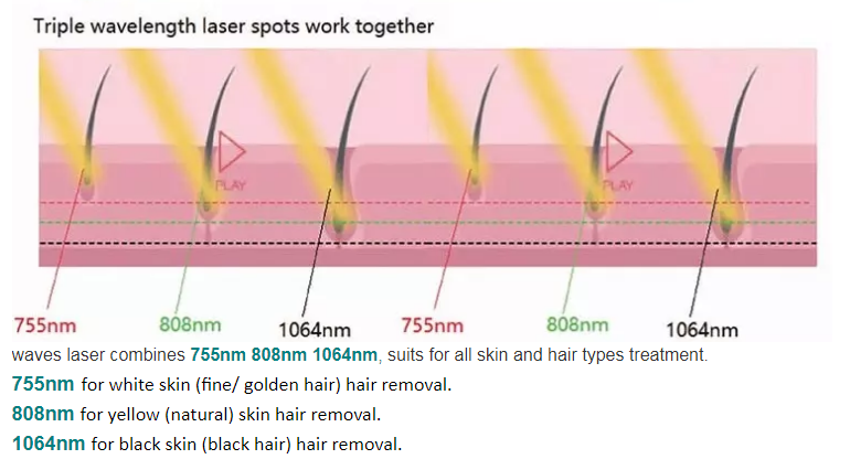 Custom Multifunctional Beauty Machine 808nm Q Switched Nd YAG Laser For Skin Lightening